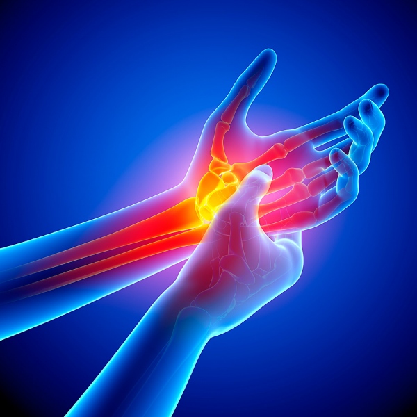 Dolor -Adormecimiento en tus manos?